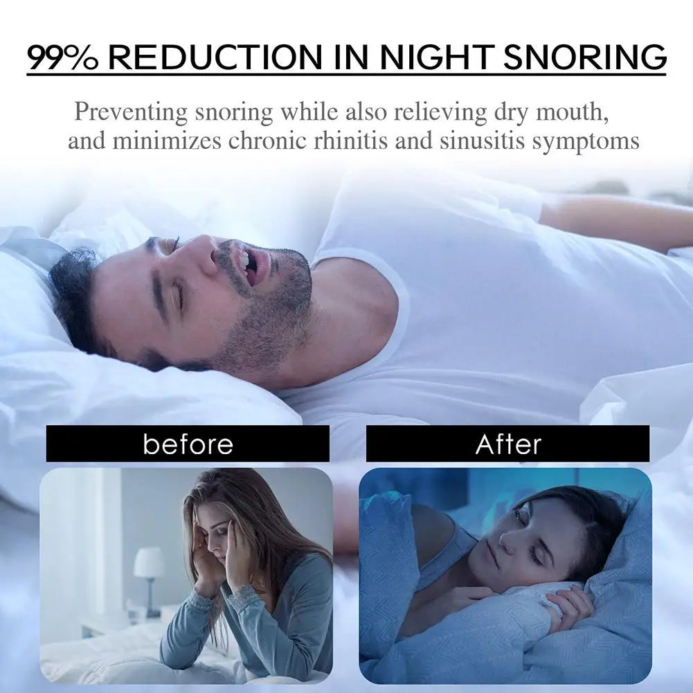 Anti-Snoring Mouth Tape – 30pcs Nose Breathing Sleep Strips
