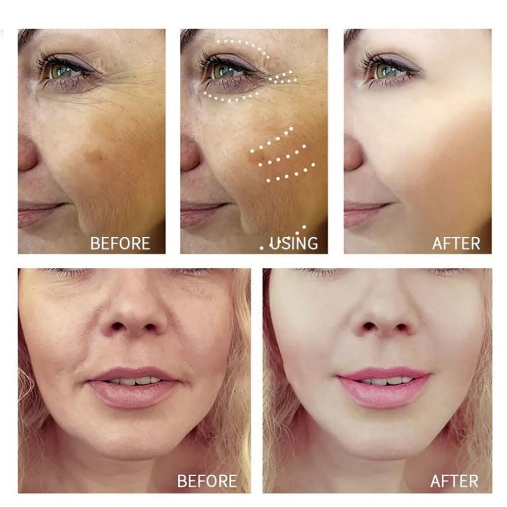 Retinol Lifting Cream