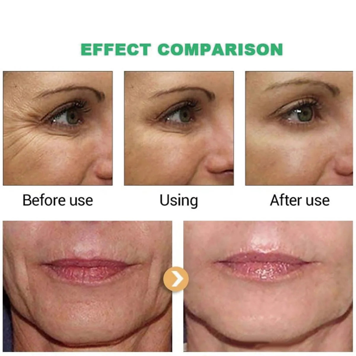 Retinol Lifting Cream