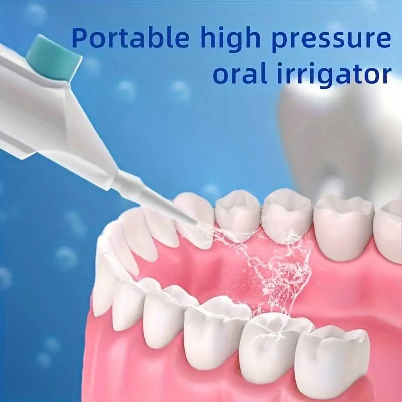 High-Pressure Oral Irrigator – Portable Manual Water Flosser