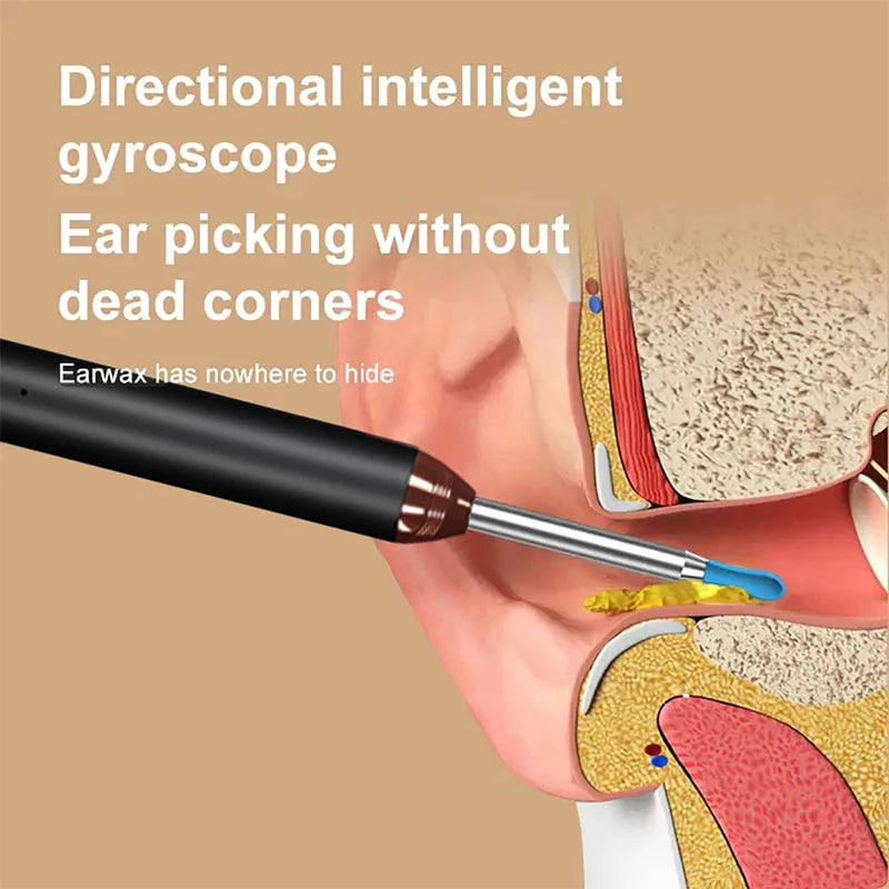Smart Visual Ear Cleaner – WiFi Otoscope with USB-C Charging